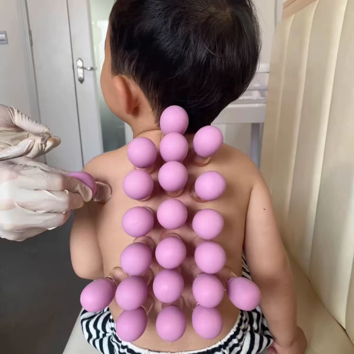 Silicone Cupping Set 🧴 Home Facial & Body Therapy Massage Cups