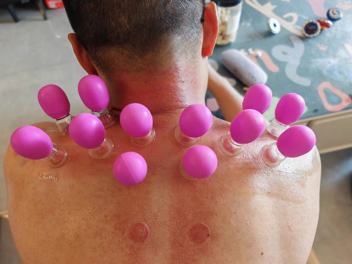 Silicone Cupping Set 🧴 Home Facial & Body Therapy Massage Cups